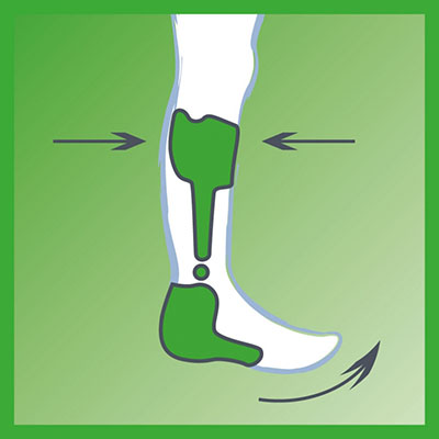 rahm_AFO-schwing-gelenk rahm sanitätshaus versorgung beratung hilfe pflegehilfe Pflegebedürftigkeit neurologische Erkrankungen