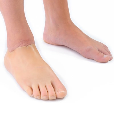 Teilfußprothese, Prothese fuer den Fuß aus Silikon vom Sanitaetshaus rahm Zentrum füer Gesundheit