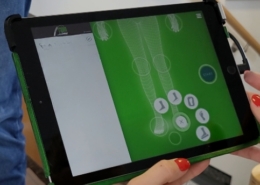 Unsere Kundin bekommt maßgefertigte orthopädische Schuhe