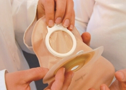 High-Output Stoma was tun