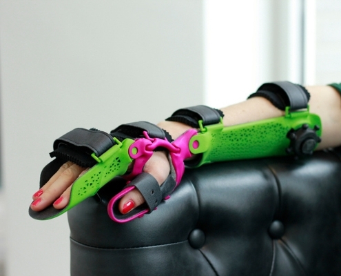 rios AktivEx rios AktivEx hilft dabei, den Arm in einer schmerzlindernden Position zu lagern.