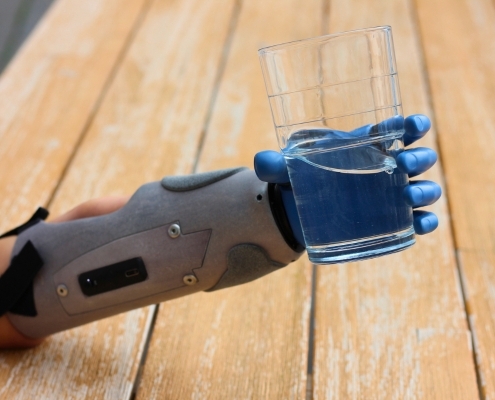 rios Armprothese rahm Kunde kann dank rios Armprothese ein Wasserglas halten.